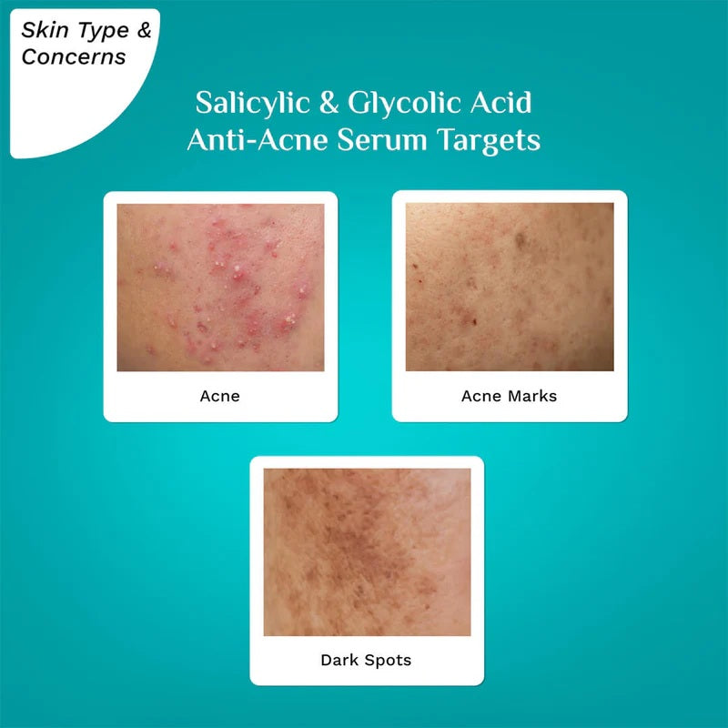 PILGRIM ANTI ACNE FACE SERUM