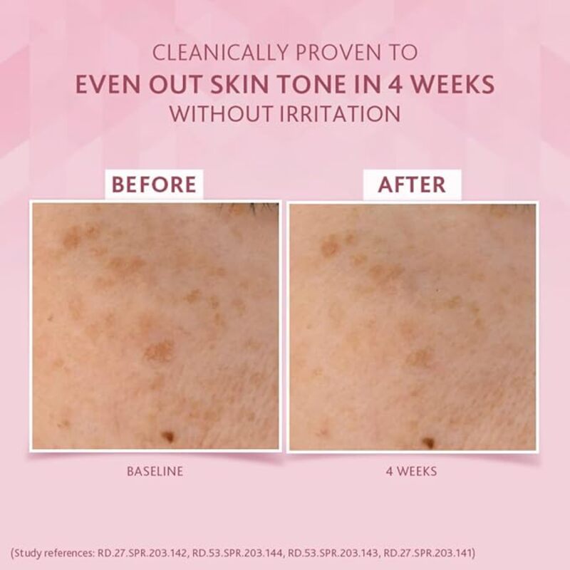 Before and after skin tone comparison on a pink background.
