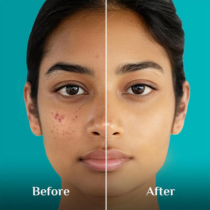 PILGRIM 10% NIACINAMIDE FACE SERUM