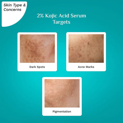 PILGRIM 2% KOJIC ACID SERUM